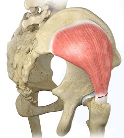 Hip Adductor Injuries