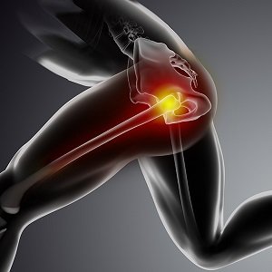 Physical Therapy for Hip