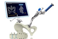 Robotic Total Hip Replacement